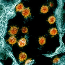 This colorized transmission electron micrograph shows SARS-CoV-2 virus particles (orange), isolated from a patient. Credit: NIAID via NIH This colorized transmission electron micrograph shows SARS-CoV-2 virus particles (orange), isolated from a patient. Credit: NIAID via NIH