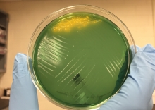 Cholera on Agar Plate