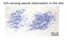 By Yanyan Xing, postdoc researcher in Dr. Liang Han’s lab