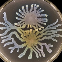 Pseudomonas aeruginosa (Photo by Steve Diggle/Georgia Tech)