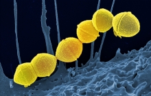 Group A Streptococci NIAID