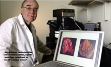 John McDonald, co-director of the Ovarian Cancer I John McDonald, co-director of the Ovarian Cancer I